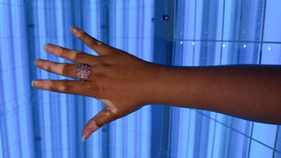 Hospital Dermatológico do Paraná é referência no tratamento integral e gratuito de vitiligo