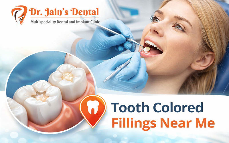 Tooth Colored Fillings Near Me