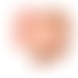 弛緩性便秘