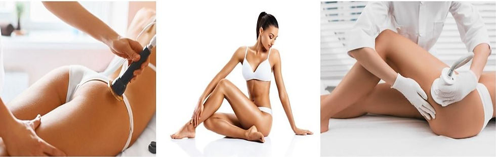 group-pic-cellulite-1.jpg