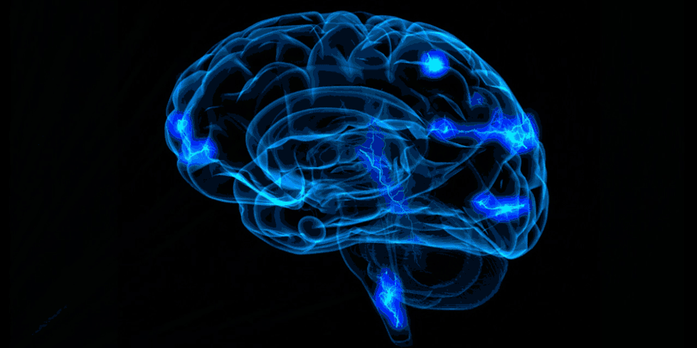 cerebro-gif.gif