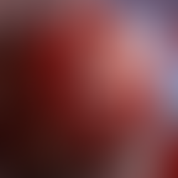 Q&A with Vascular Surgery Specialist, Dr. Zayed