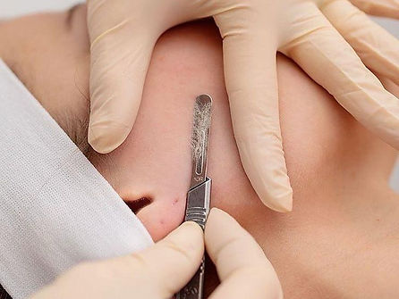 Derma-Llanura