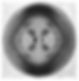 X-ray diffraction image of DNA