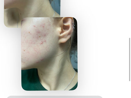 Testimonial