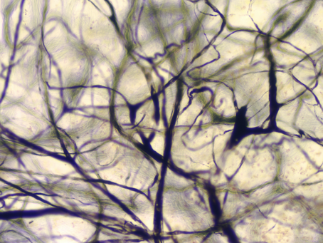 Advanced Solutions Discovers a Way to Guide New Blood Vessel Growth Across Tissue Boundaries