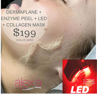 Dermaplaning Adelaide