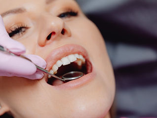 Ästhetische Zahnfüllungen: Alle Infos auf einen Blick