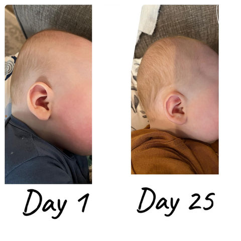 before and after results from using The PerfectNoggin