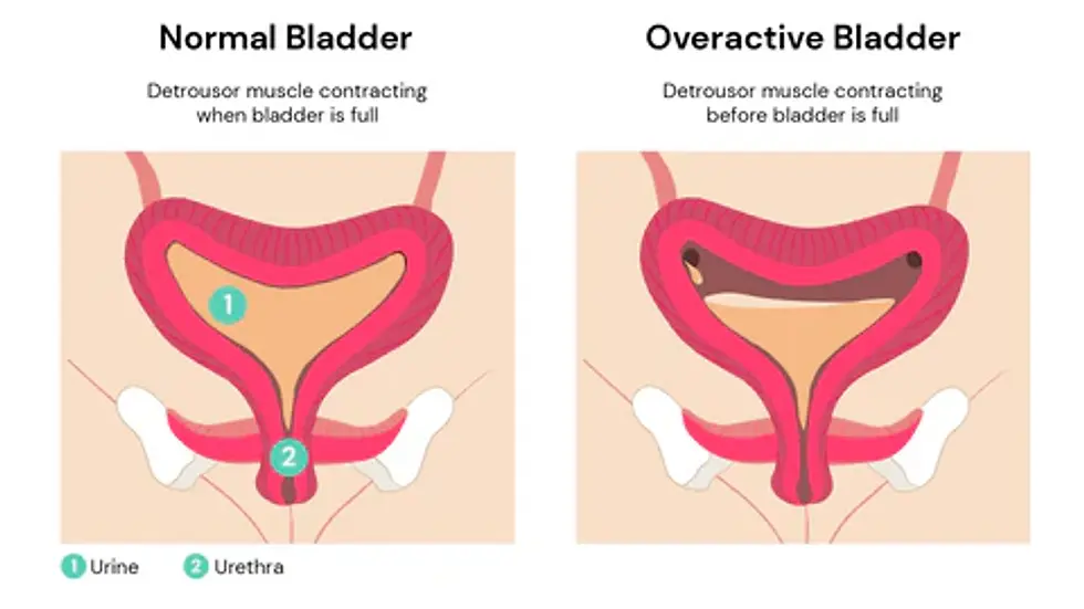 Pelvic floor muscles supporting bladder control illustration