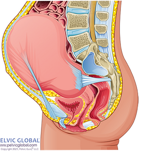Round Ligament Pain: Understanding, Home Remedies, and the Role of Pelvic Physical Therapy
