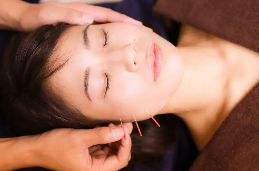 TMJ dry needling 