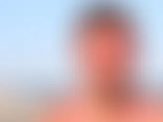 Sunburn and Piercings