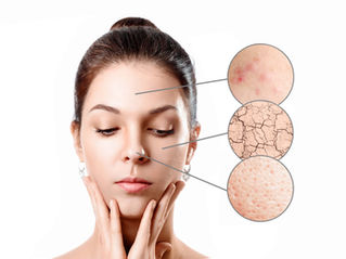 Harmonizing the Skin: The Yin and Yang of Oil Control and Hydration Through Medical Aesthetic Strate