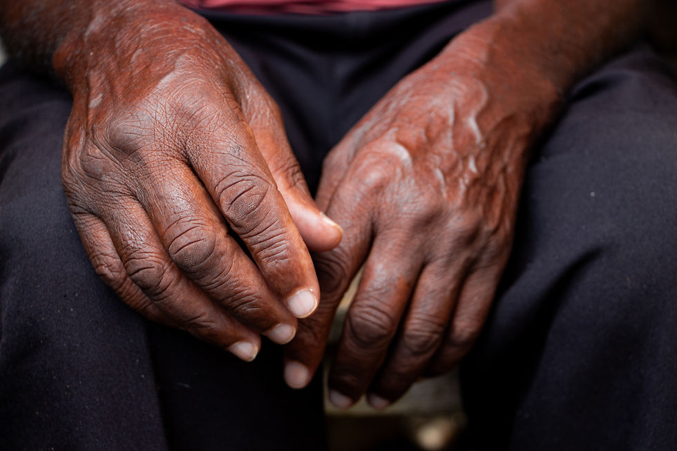 A imagem apresenta um close nas mãos apoiadas sobre o colo de uma pessoa idosa negra. As mãos aparecem relaxadas, com a pele marcada por rugas e veias aparentes.