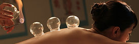 FEAT-fire-cupping.jpg