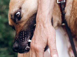 Dog biting a person’s hand during an attack, causing potential injury and prompting need for legal help in Colorado Springs.