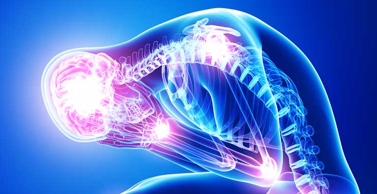 X-ray styled image of a person holding their head, highlighting the spine and brain in pink against a blue background, suggesting stress.