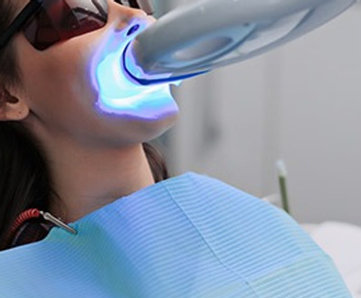 teeth whitening_edited.jpg