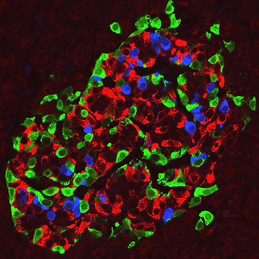 Human pancreatic islet