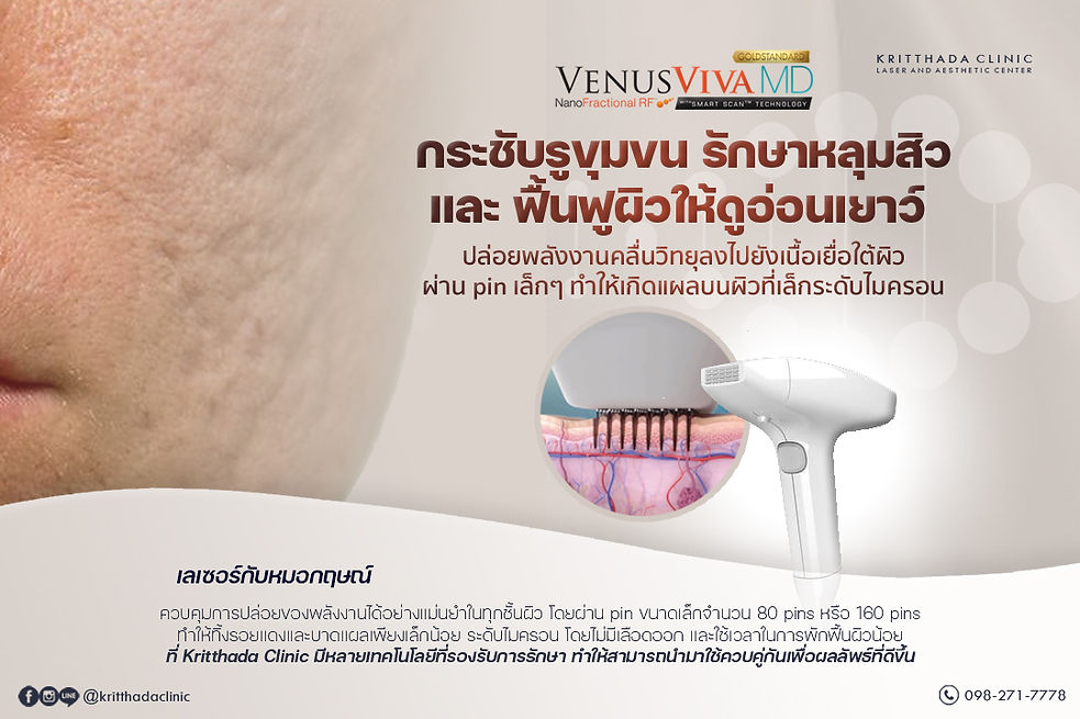 Venus Viva MD ทำที่ไหนดี Kritthada Clinic