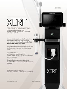 XERF