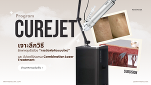 CureJet subcision for acne scars treatment in Bangkok
