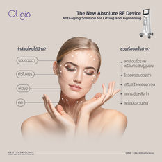 Oligio ทำส่วนไหนได้บ้าง