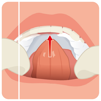 elemental-stent-priprava-2.png