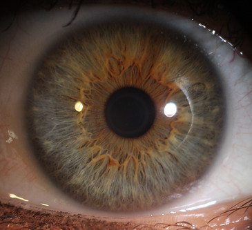 Irisdiagnose, ganzheitliche Diagnostik, individuelle Therapie, Naturheilkunde TEN Horgen, Sabrina Schenkel, Sana vita