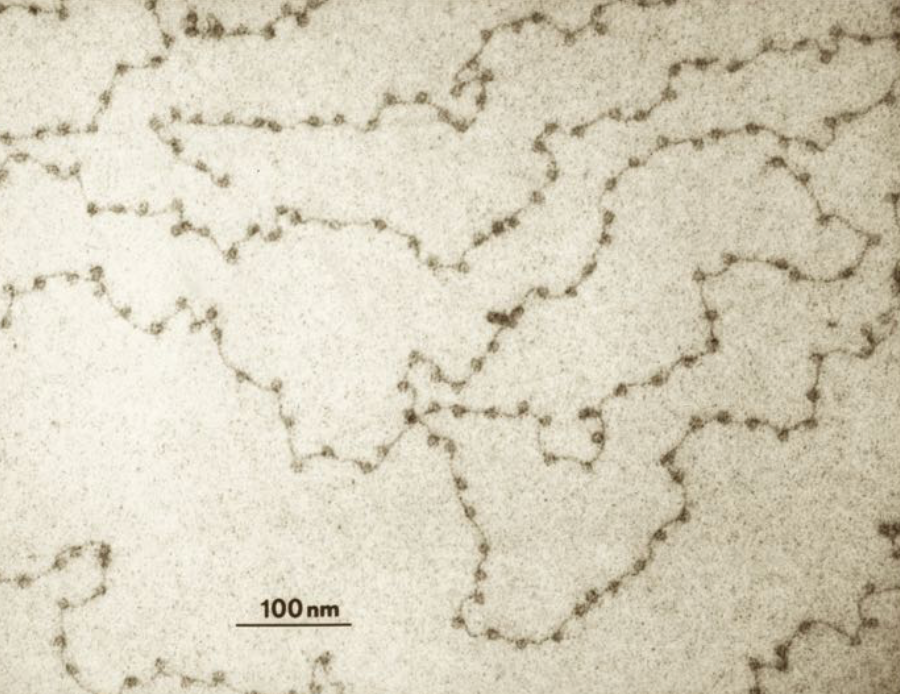 Beads-on-a-string (chromatin): DNA wraps around histone proteins to form nucleosomes (the beads). The naked DNA linker connecting the nucleosomes is the string. The chromatin form of DNA includes DNA, histone proteins and non-histone proteins attached to the histones and/or DNA.
