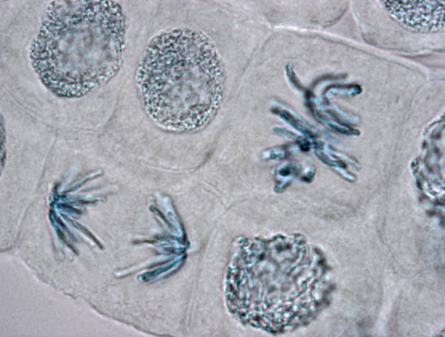 Mitosis microscopy: High scale magnification of plant cells in metaphase (upper right) and in late anaphase (lower left)