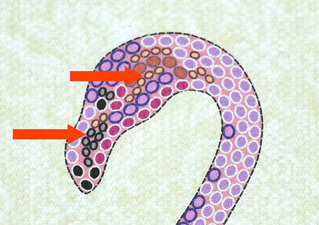 where to place micro beads