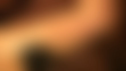 脂肪吸引後のボディコンディションケアについて