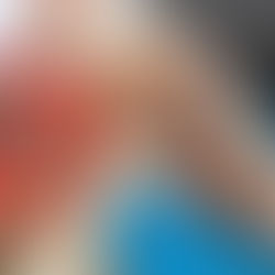 Fiebre amarilla acecha a Norte de Santander: 17 municipios en alto riesgo