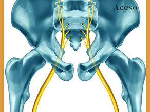 Do you have sciatica? Here is everything you need to know.

