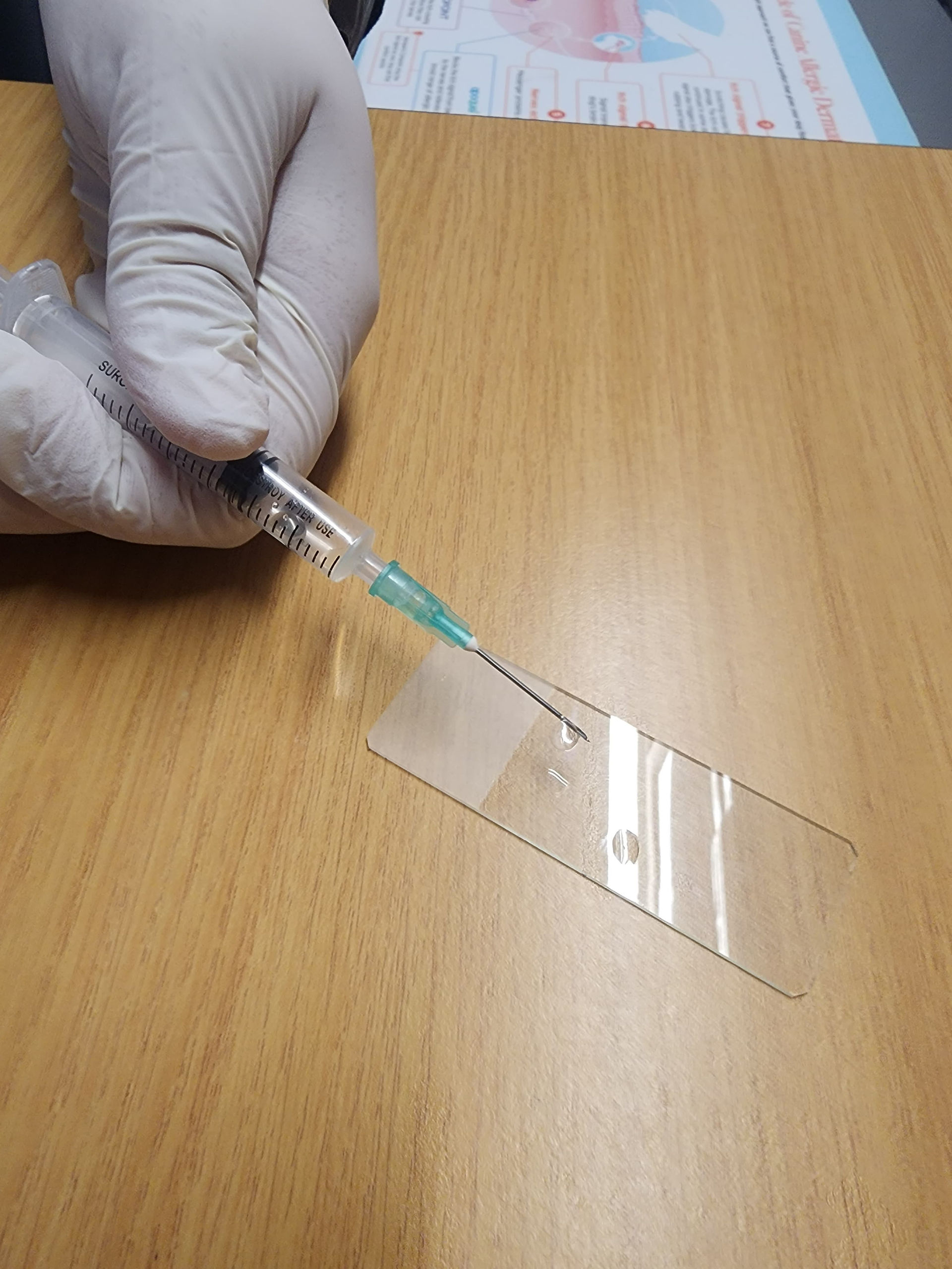 FNA