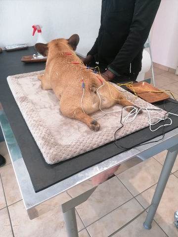 Acupuncture