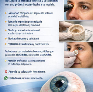 ¡Prótesis Oculares Personalizadas en Puerto Barrios, Guatemala!