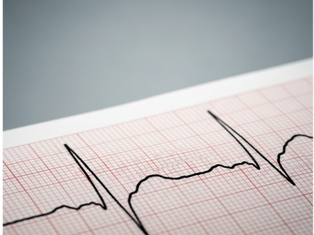 Choosing the Right ECG Leads: A Guide for Healthcare Professionals