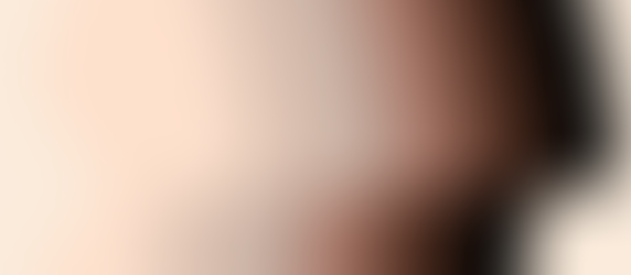 The Problem With Representation