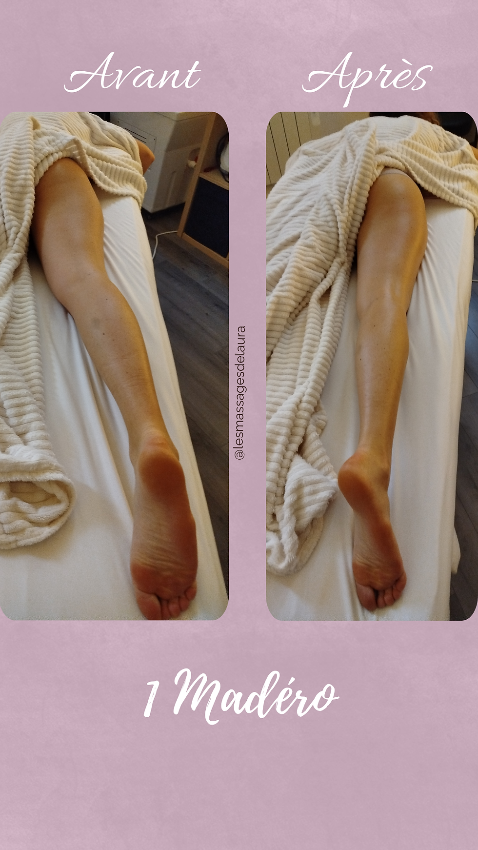 Madérothérapie Montigny-le-Bretonneux – Massage sculptant & tonifiant