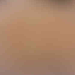 Peel and dice the eggplant finely. Sprinkle lightly with salt and let it sit for 10-15 minutes to draw out bitterness. Pat dry with paper towels.