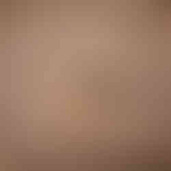 Cover and let rise in a warm environment (75–80°F / 24–27°C) until dough has puffed and expanded noticeably (about double in size).