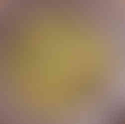 Add the chopped broccoli, grated squash, and garlic (if using) into the egg mixture. Stir until evenly combined.