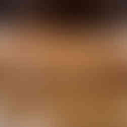 Preheat the oven to 375°F (190°C). Arrange the patties on a baking sheet lined with parchment paper. Brush them lightly with melted ghee. Bake for 15-20 minutes, flipping halfway, until golden and fully cooked.