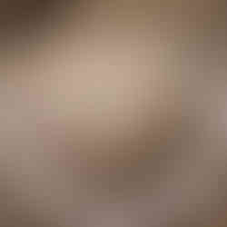 Preheat oven to 475°F (245°C) with a Dutch oven inside for at least 30 minutes. Turn the dough out onto parchment, score with a sharp blade or lame, and carefully place into the preheated Dutch oven. Bake covered for 20 minutes Then uncover, reduce temperature to 450°F (230°C), and bake another 20–25 minutes until deeply golden and internal temperature reaches ~205°F (96°C).