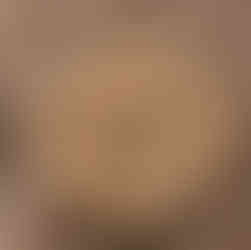 Divide into 8 equal balls and shape each into a smooth round. Arrange evenly in a greased 8- or 9-inch round cake pan.