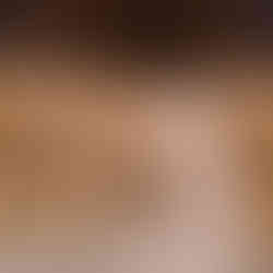 Bake: Preheat oven to 375°F (190°C). Arrange dough balls seam-side down on a parchment-lined baking sheet. Let rest for 15 minutes. Bake for 12–15 minutes until golden brown.