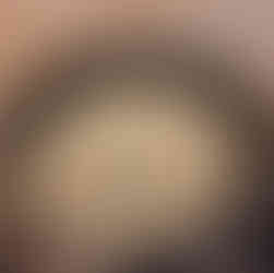 Heat a nonstick skillet over medium heat. Sauté the chopped onion in a little oil or butter until translucent, about 3-5 minutes. Add the eggplant and continue to cook, stirring occasionally, until both are soft and golden, about 7 minutes. Let cool.